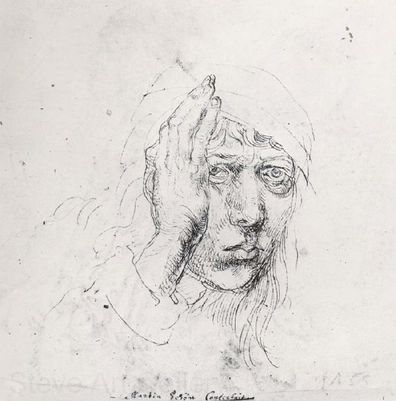 Albrecht Durer Sele-Portrait with Bandage